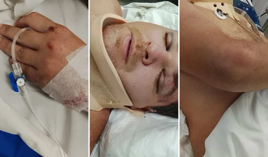 Internaron en grave estado al hombre robado por motochorros en La Plata: “Tiene sangrado cerebral”